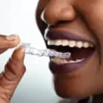 woman with clear dental aligner